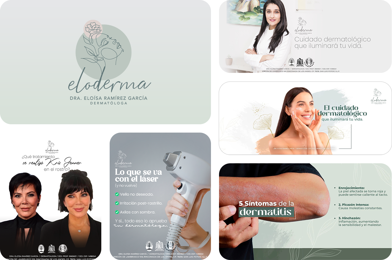Eloderma